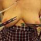 Nipple torture